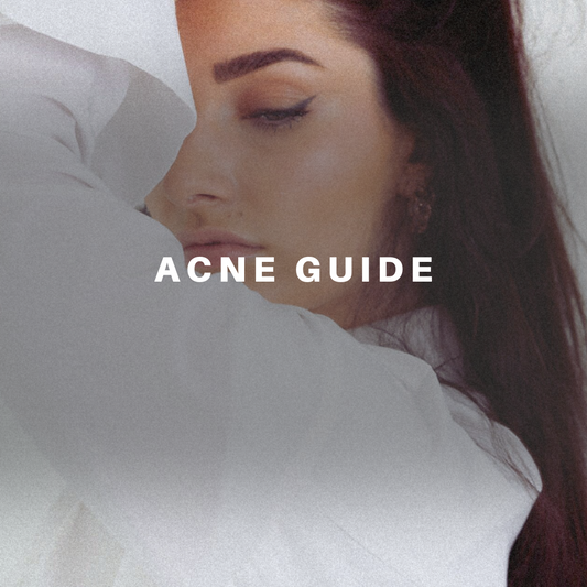 The Smash Acne Guide